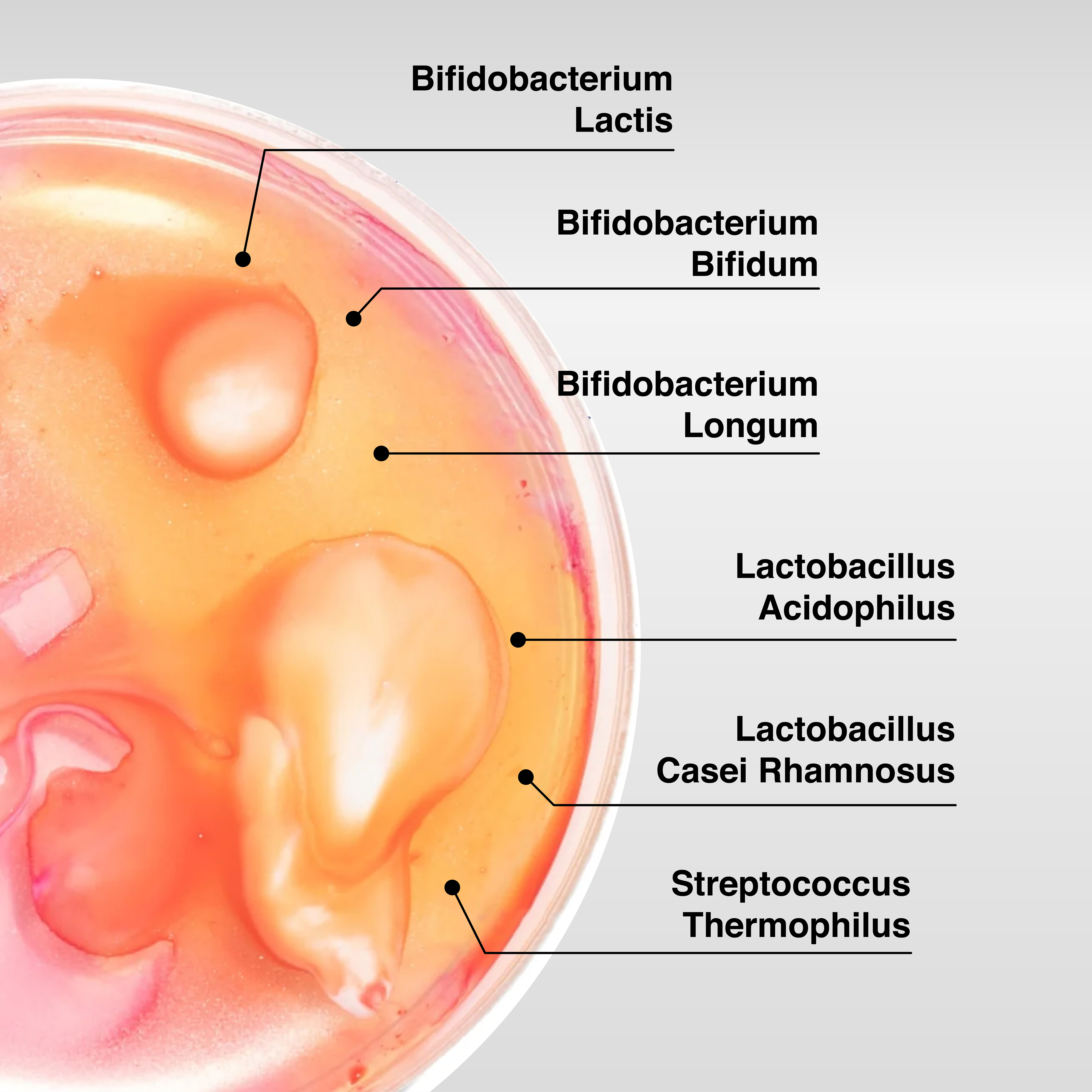 Why Do We Need Probiotics and Why 10 Billion CFU is Optimal for Best Results?